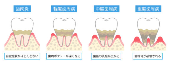 拡大イメージ